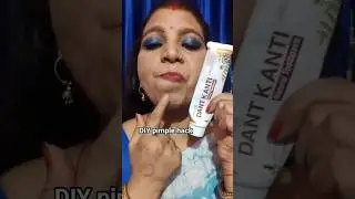 DIY Pimple hack😱Quick fix of yourpimple #diy #hack#pimplesolution#shorts#sonalimakeover