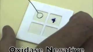 Bacterial oxidase test.mov