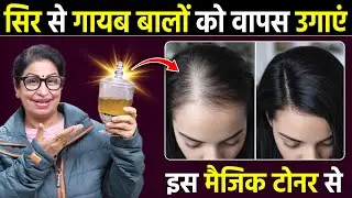 ये HAIR REGROWTH TONER लगा लो - गंजे सिर पर भी 100% नए बाल उगा देगा | DIY Fast Hair Growth Serum