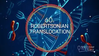 Genetics in 60 seconds: Robertsonian Translocation