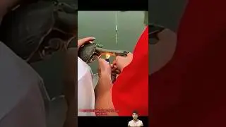 Ch&agrave;ng trai bị con baba n&oacute; cắn v&agrave; tự giải tho&aacute;t cho m&igrave;nh - boy bitten by turtle