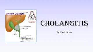 Cholangitis - causative organism, Charcot's triad, Reynold's pentad, investigation, treatment