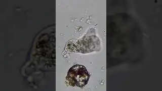 Spend 5 minutes with an Amoeba! 