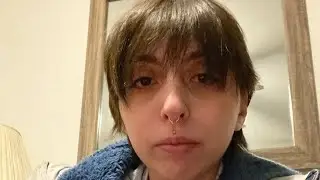 3 week Update Philtrum piercing