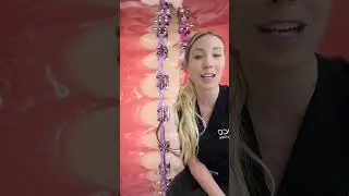 Braces adjustment appointment. #shorts #braces #orthodontics #appointment