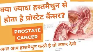 Prostate#masturbation@the.pharmaguru #benfit of masturbation#prostate #cancer #prostate gland