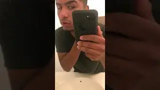 Closing my stretched ears. NO SURGERY!