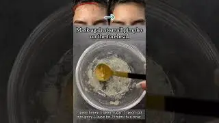 forehead pimples removing tip