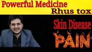 Powerful Medicine for Pain & Skin Diseases | Rhus toxicodendron | Symptoms | how to use |