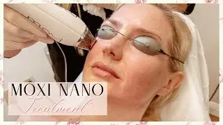 MOXI NANO Laser Treatment | Skin Before & After | Healing Process