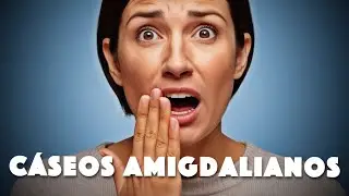 Mau H&aacute;lito por C&aacute;seos Amigdalianos: Como resolver?