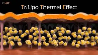 Surgen Hybrid Energy & TriLipo & TriFractional Combined