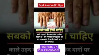 Kala Urad for White Spots 😯 | सफेद दाग का घरेलू इलाज | Ayurvedic Skin Care Tips in Hindi #healwithdr