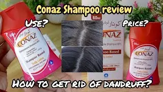 Conaz Shampoo Review🧴| Best Anti-Dandruff Shampoo for Itchy Scalp🧖&zwj;♀️