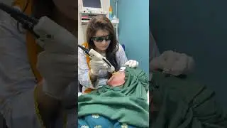Best Laser hair removal machine (American candela )