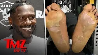 NFL Player's Disgusting Foot Injury Caused By 'Cryogenic Chamber Mishap' | TMZ TV