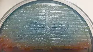Enterobacter aerogenes growth on CLED Agar