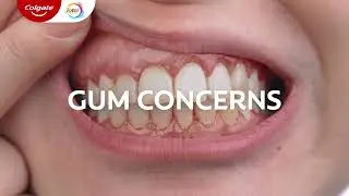 Get ahead of gum concerns with Colgate Total!