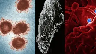 waterborne diseases | Bacterial | viral |protozoal |parasitic |Arseniocosis | Fluorosis infections :