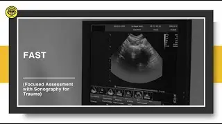 USG FAST Focused Assessment with Sonography for Trauma