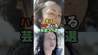 実はハゲている芸能人4選