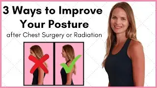 Posture Correction Exercises after Chest Surgery - How to Fix Rounded Shoulders & Improve Posture