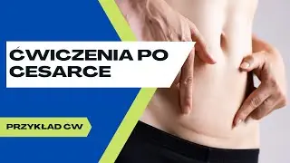 Cięcie cesarskie - przykład ćwiczeń indywidualnych