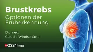 Mammographie vs. Alternativen: Die Debatte um die wirksamste Brustkrebsvorsorge | QS24