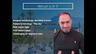 Hip expansion is the key element of our body contouring technique.