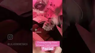 Dermaplaning and Nano infusion facial . #acne #oilcleansing #skincare