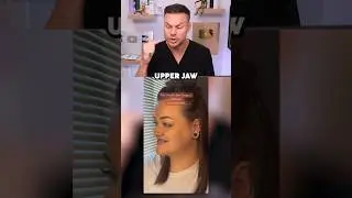 Double Jaw Surgery Changed Her LIFE! 😮🦷