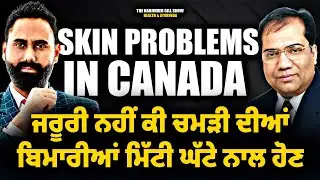 Skin Problems in Canada | Not All Skin Diseases are Caused by Dirt or Dust | Health and Ayurveda