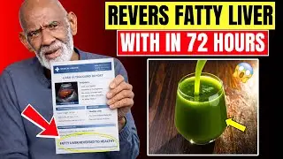 Dr. Sebi&rsquo;s 3-Step Morning Routine That Helps Reverse Fatty Liver Naturally