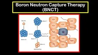 Boron Neutron Capture Therapy (BNCT), Nuclear Chemistry - Treatment of Cancer, JAM 2014 Chemistry