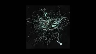 𝖕𝖗𝖊𝖒𝖎𝖊𝖗𝖊#083 📢 Sqimer - Silent Tide [Human Disease Network]