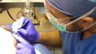 Interested in Hair Restoration? Dr. Shah Performs the NeoGraft Procedure!