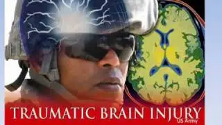 Trail Making Test, Pruebas, demencia, lesi&oacute;n cerebral, Secuencia, SpecialtyAutomated