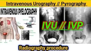 IVU / intravenous urography in hindi / intravenous urography / Radiography Procedure #radiography