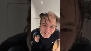 Лысеет в молодости&hellip;? 😔
