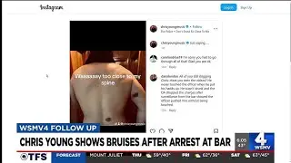 Chris Young shows bruises after arrest at bar