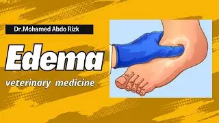 Edema-شرح محاضره بالعربي