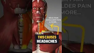 😩 Your headache could be due to weak muscles in the neck