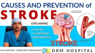 Can strokes be reversed? | causes and prevention of stroke| DRM Hospital Mysore