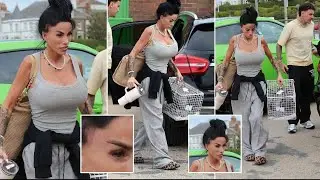 Katie Price displays extreme weight loss and a painful-looking eye injury as she arrives for 