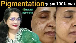 World's Best Remedy For Pigmentation & Dark Spots @RizwanaBeautyRemedies 