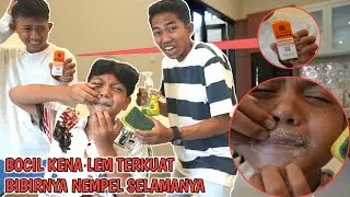 YA AMPUN BIBIR BOCIL KENA LEM SAMPE GAK BISA DIBUKA??😱 Arik Panik | Mikael TubeHD