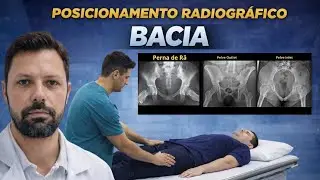 RAIO-X M&Eacute;TODO DE CLEAVES MODIFICADO (PELVE R&Atilde;) BACIA INLET E BACIA OUTLET (M&Eacute;TODO DE TAYLOR)