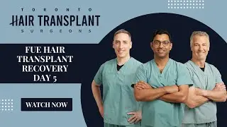 FUE Hair Transplant Recovery | Day 5