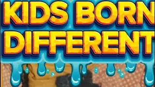 Kids Born Different / First 3 days on Youtube with real voice #basedonatruestory 