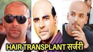 ये बॉलीवुड सुपरस्टार हो चुके है गंजे , लगाते है नकली बाल | Hair Transplant Surgery